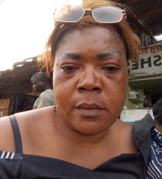 Nadine Expert T, 44 years old, Straight, Woman, Bangangte, Cameroon